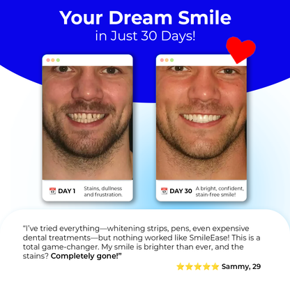 SmileEase - 360° U Shaped Smart Electric Toothbrush